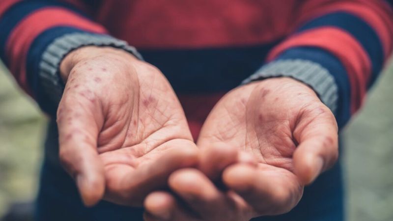 Lo 0,001% della popolazione mondiale ha tre volte la ricchezza della metà più povera dell’umanità